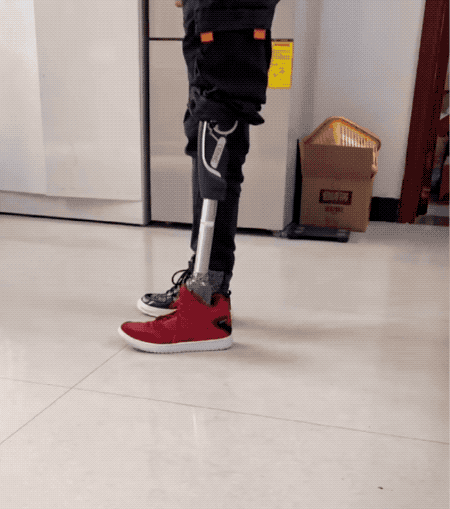 DIY自平衡车意外失去左腿后，小哥爆改假肢玩出花变身野生钢铁侠