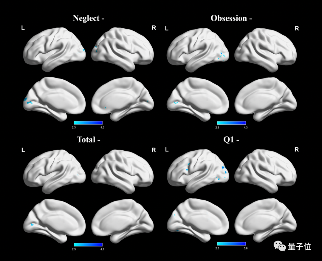上网成瘾改变大脑结构：语言功能受影响，让人话都说不利索