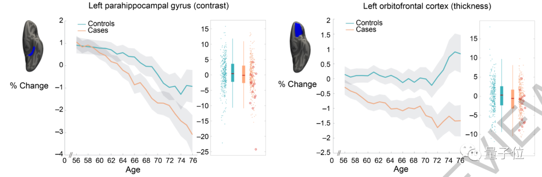 新冠轻症也会导致大脑退化，牛津大学最新研究登上Nature
